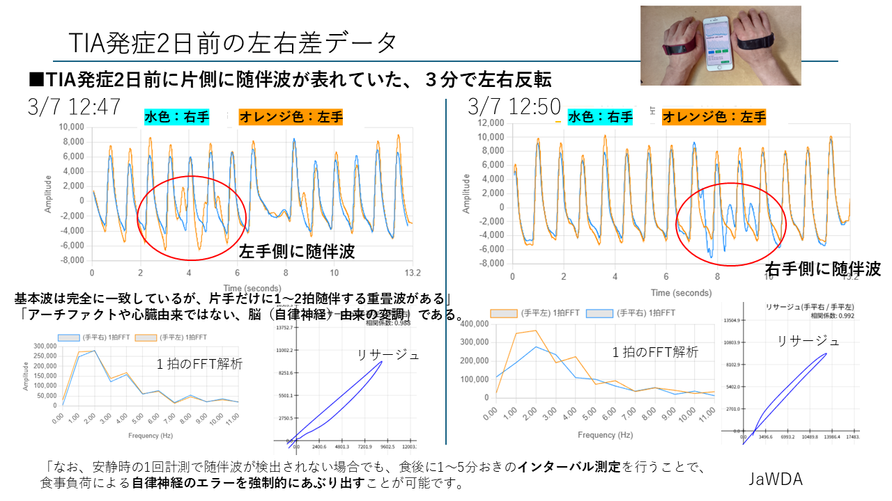 TIAスクリーニングう