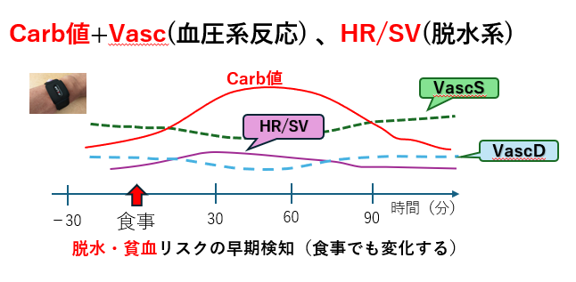 Vasc説明