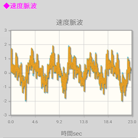 腹部速度脈波