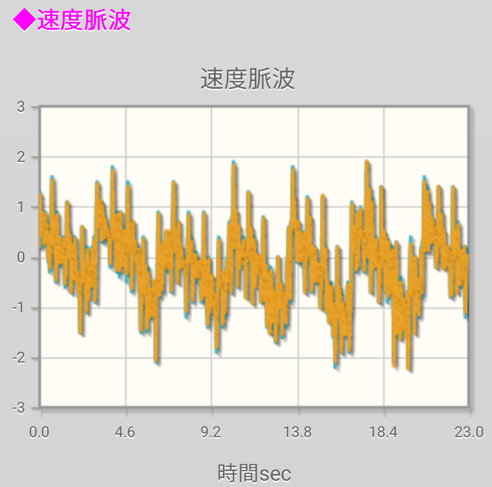 食後：腹部速度脈波